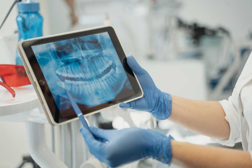 Οδοντιατρική ακτινογραφία (X-ray) που εμφανίζεται σε ταμπλέτα